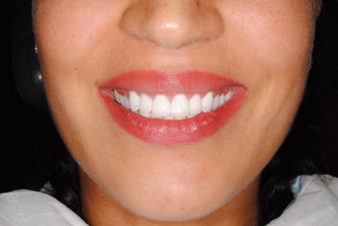 10 Tipps Fur Weisse Zahne 10 Tipps Fur Weisse Zahne