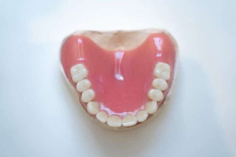 3 Arten Von Zahnersatz. Welche Ist Das Beste Für Sie? | Centrocc Dental